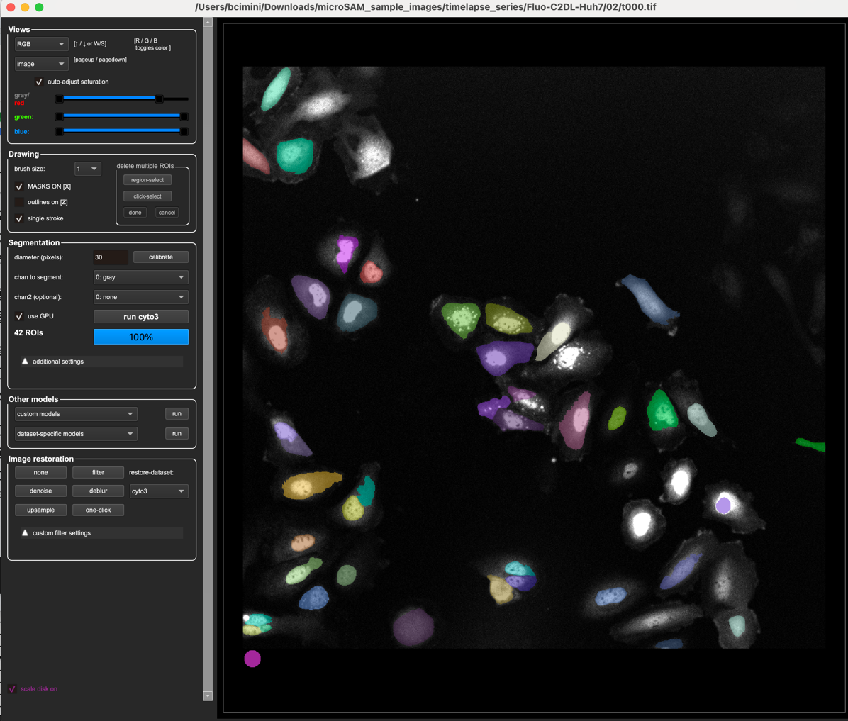 cyto3 on fluorescence image