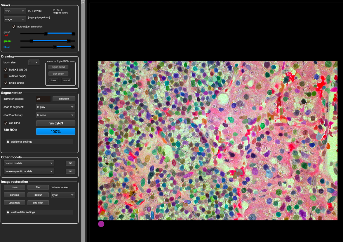 cyto3 on pathology image