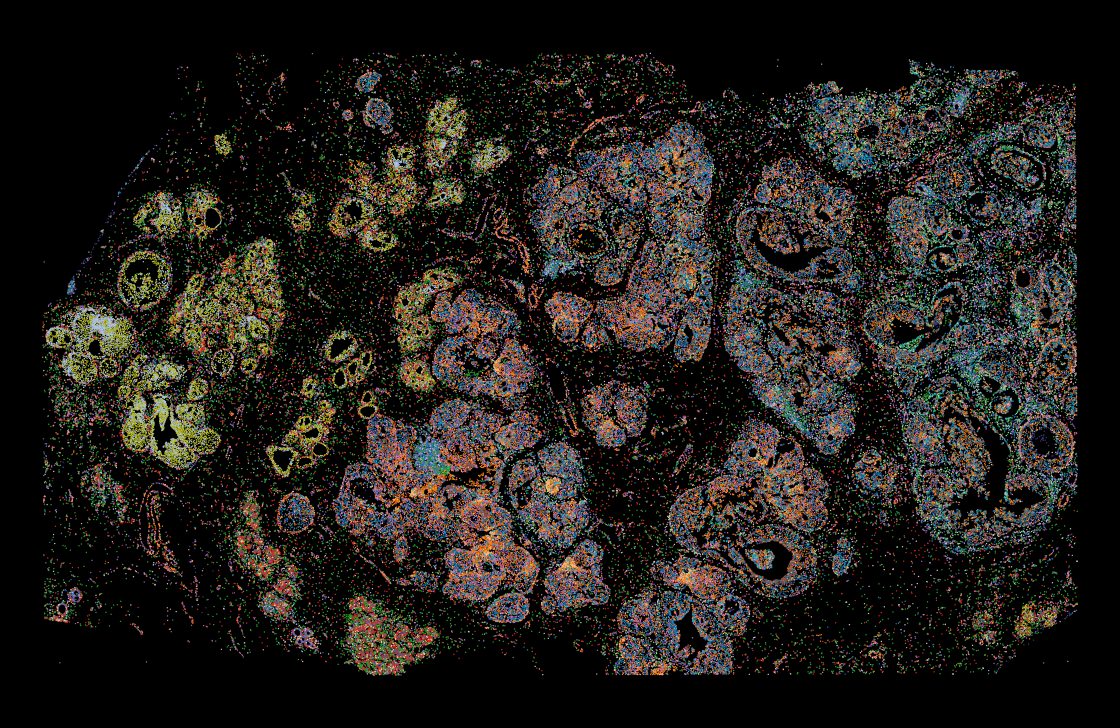 Default cell clusters in Atera breast cancer