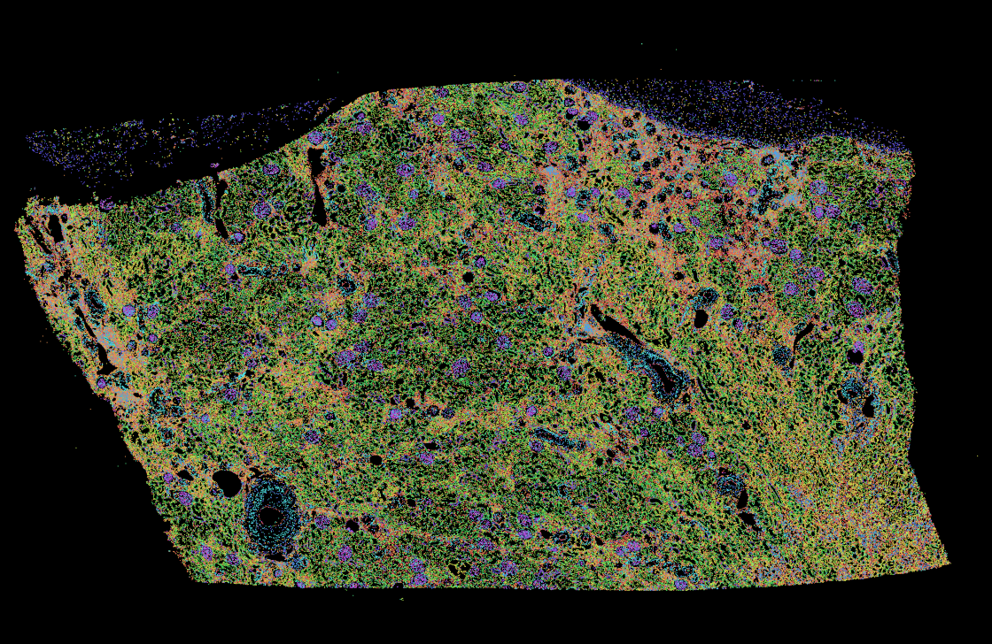 Default cell clusters in Atera kidney